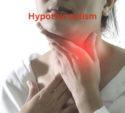 How to Identify Hypothyroidism: Common Symptoms and Solutions