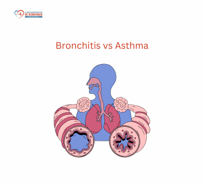 Bronchitis vs. Asthma: How to Tell Them Apart