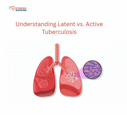 active-tuberculosis