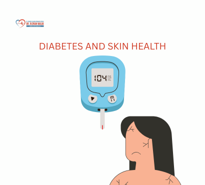 Diabetes and Skin Health – Symptoms You Shouldn’t Ignore