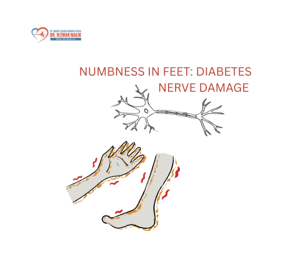 Numbness in Feet: Diabetes Nerve Damage Warning